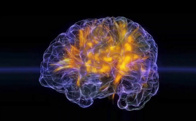 Neuro-recital: Få et kig ind i solisthjernen | Magasinet KLASSISK